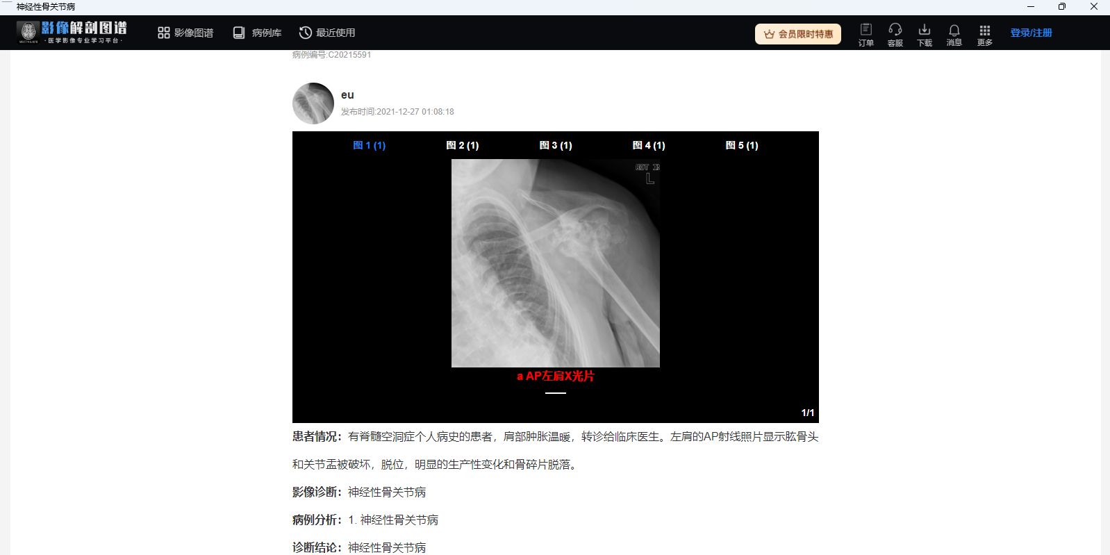 Ӱ�����ͼ��32λ��ͼ6